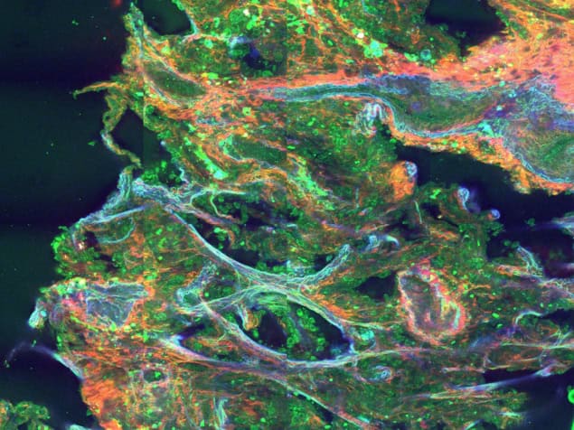 Multiphoton microscopy image of lung tissue Multiphoton microscopy image of lung tissue