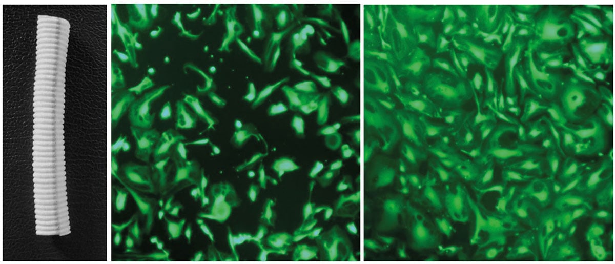 A knitted polyethylene terephthalate (PET) vascular graft