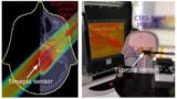 Experimental setups for phantom measurements
