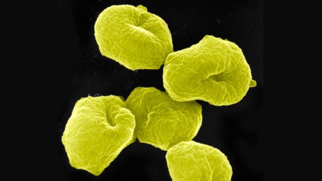 A scanning electron microscope image of Sulfolobus archaea bacteria A scanning electron microscope image of Sulfolobus archaea bacteria