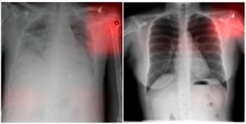 Images from a radiology deep learning model