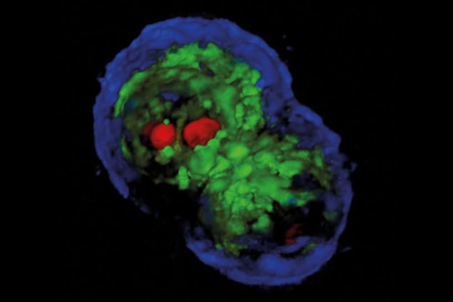 Image of colon cancer cells