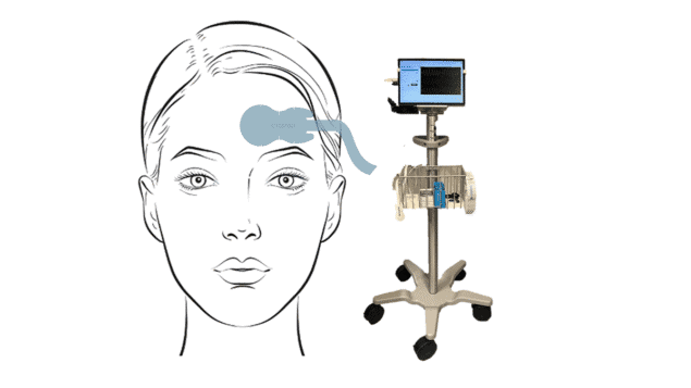 Illustration of Crainio's sensor Illustration of Crainio's sensor with a sticker attached to a person's head and a box containing the electronics