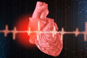 Heart illustration with ECG trace
