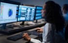 User examining MRI distortion analysis data on a screen