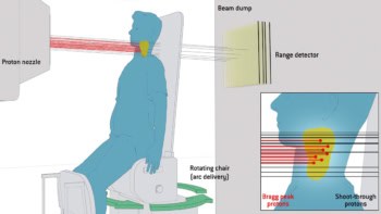 Illustration of upright static arc delivery with shoot-through layers