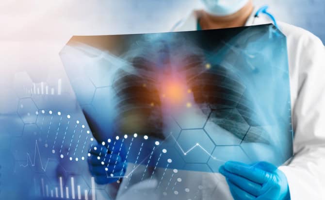 Clinicain holding a chest X-ray