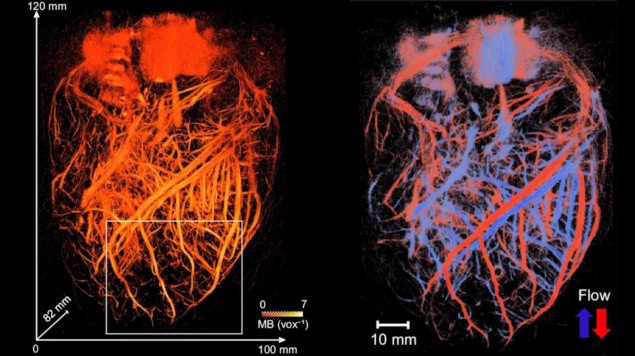 Mapping the coronary network of a pig heart