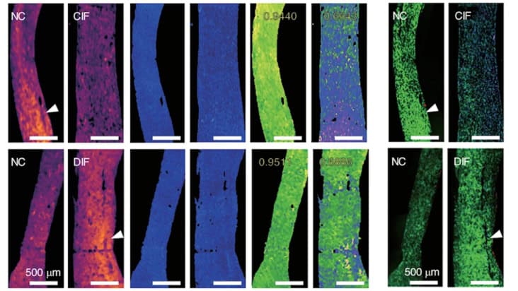 MIR-DS-PAM images of fibrotic and normal cardiac tissue