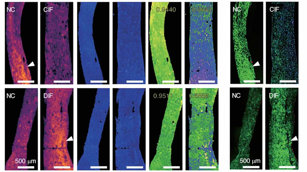 Polarization-sensitive photoacoustic microscopy reveals heart tissue health