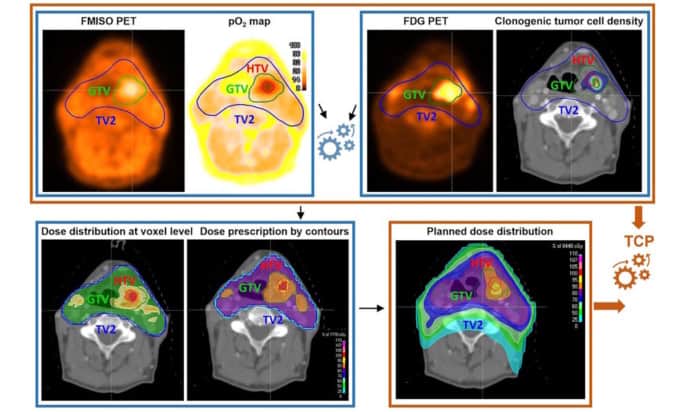 Biology-guided radiotherapy planning