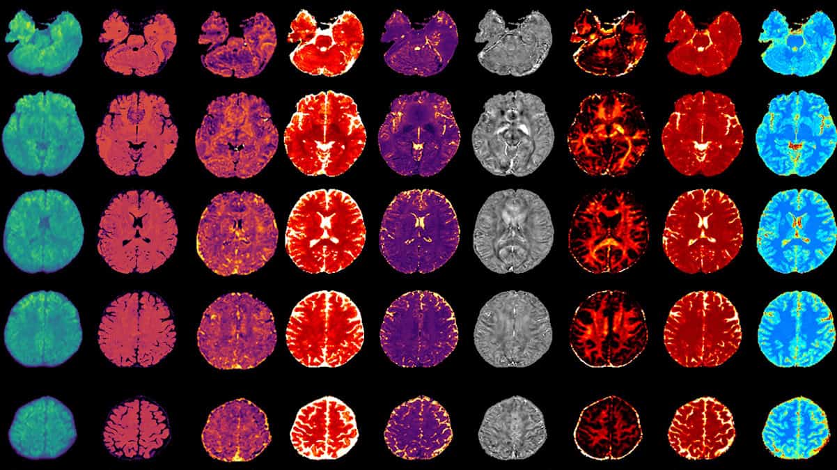 Multiplexed MRI expands the power of conventional brain imaging