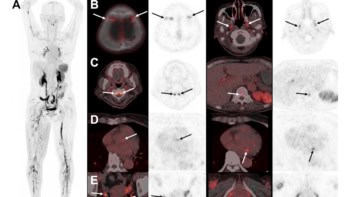 SNMMI image of the year