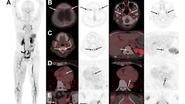 SNMMI image of the year
