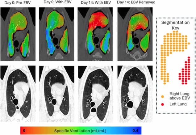 XV and CT imaging