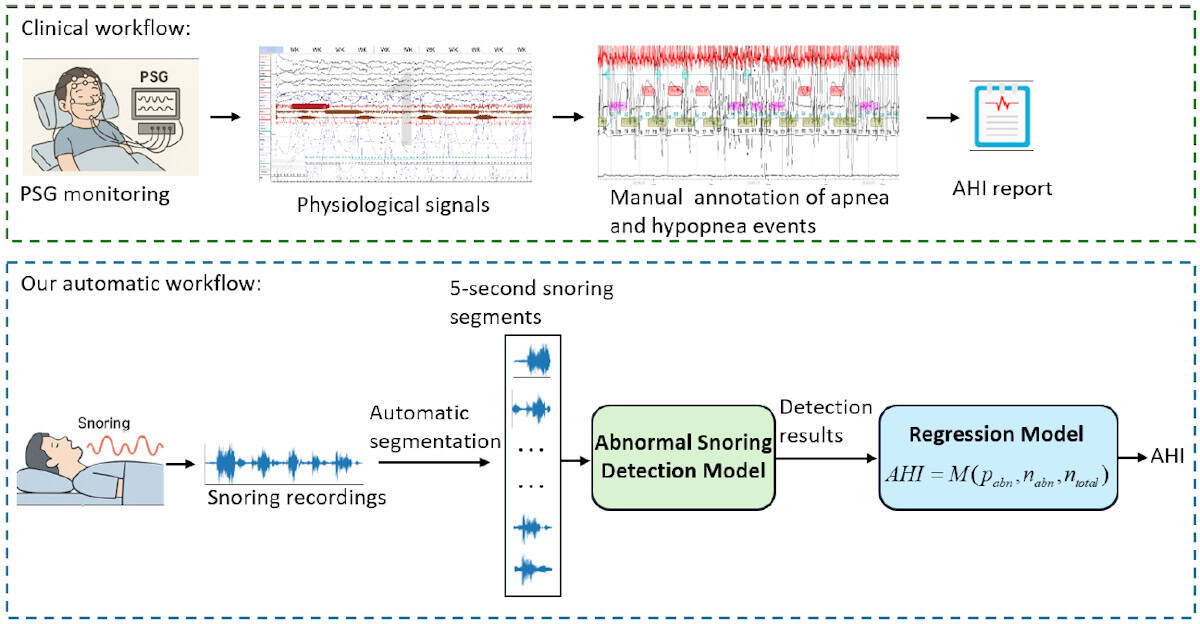 Abnormal snoring sounds help diagnose common sleep