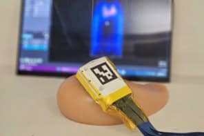A 3D ultrasound probe positioned on a tissue phantom