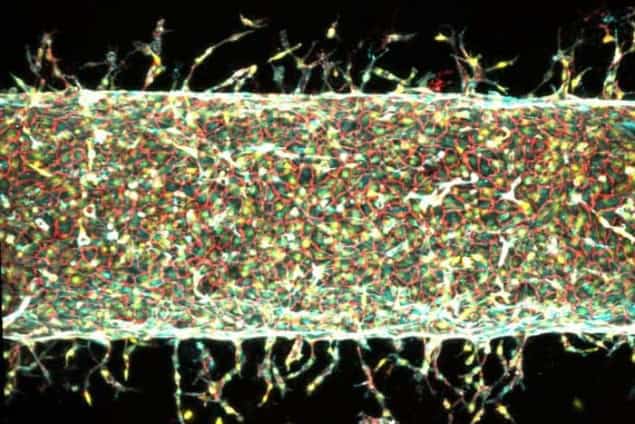 Illustration of artificial blood vessel