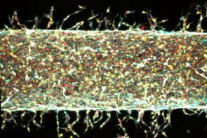Illustration of artificial blood vessel