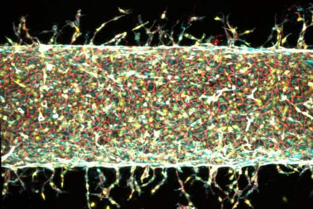 Illustration of artificial blood vessel