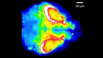 Image of a zebrafish brain during a seizure