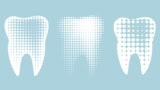 Illustration of three teeth with various textures