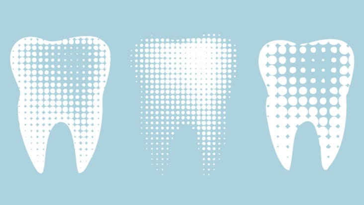 Illustration of three teeth with various textures