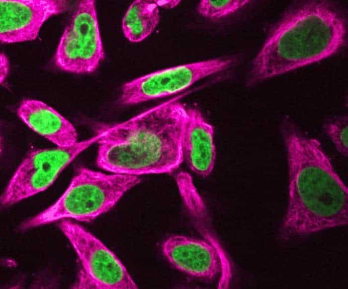 Quiz of the week: what happens to the structure and dynamics of the human genome under microgravity conditions?